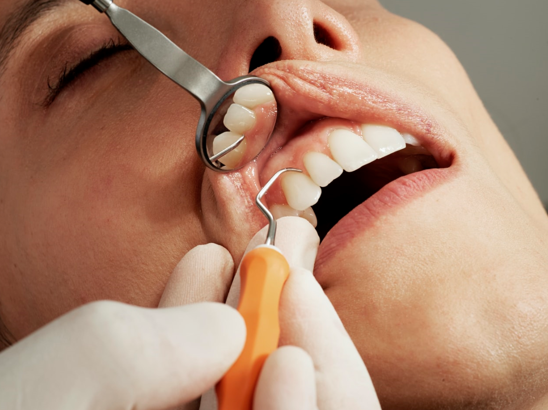 5 reasons to see a dental hygienist
